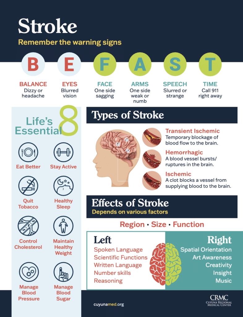 Stroke Prevention Handout